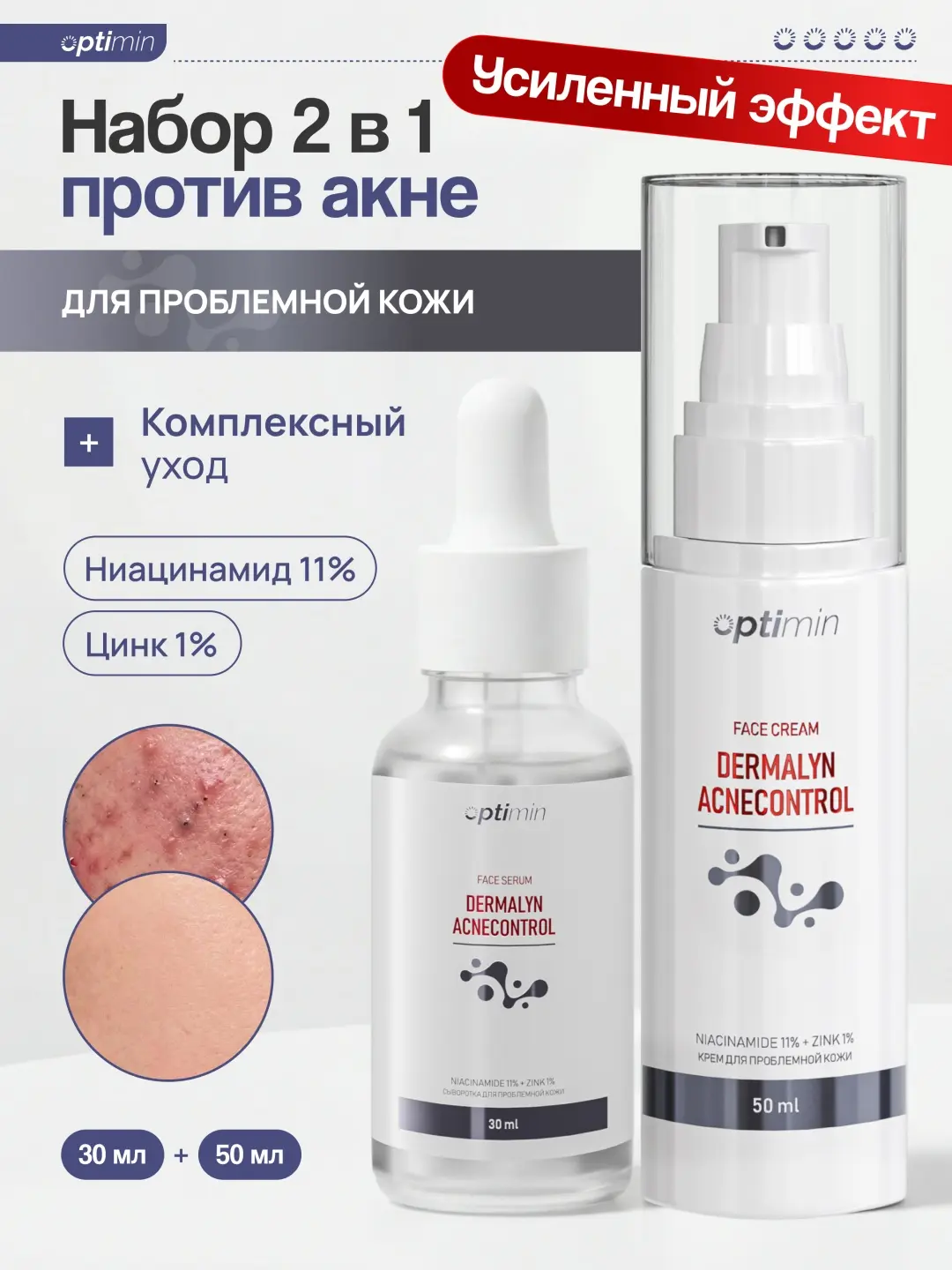 Optimin Набор 2в1 против акне